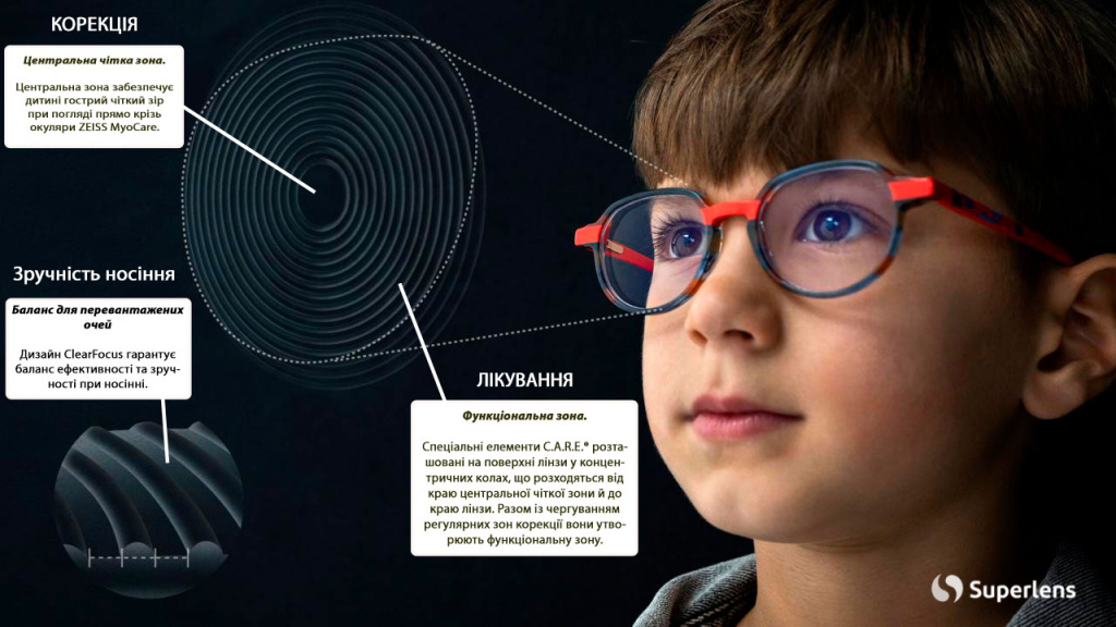 zeiss-myopia_myocare_superlens.jpg