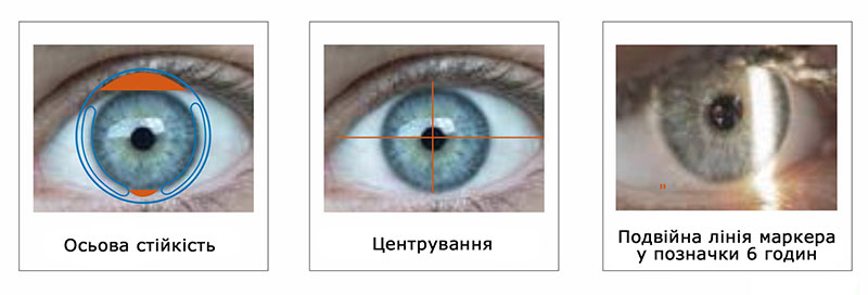 Унікальні асимметричні вертикальні тонки зони відповідають естетичному асимметричному покриттю роговиці, використовуючи естетичну силу, оптимізуючи центрирування та запобігаючи вращенню. Унікальні асимметричні вертикальні тонки зони відповідають естетичному асимметричному покриттю роговиці, використовуючи естетичну силу, оптимізуючи центрирування та запобігаючи вращенню.