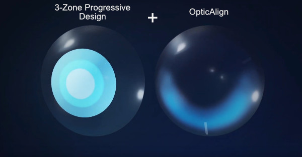 3-зонный прогрессивный дизайн и OpticAlign